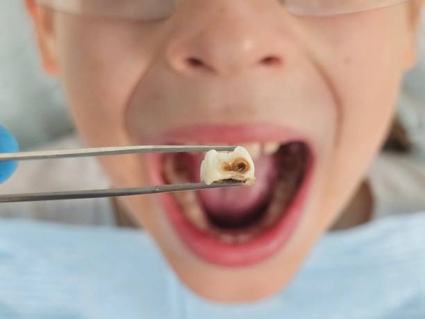 Best Urgent Dental Care  in Burke, VA